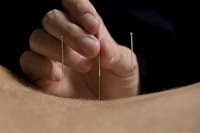 Amanda Silcock   Acupuncture in York 727118 Image 6